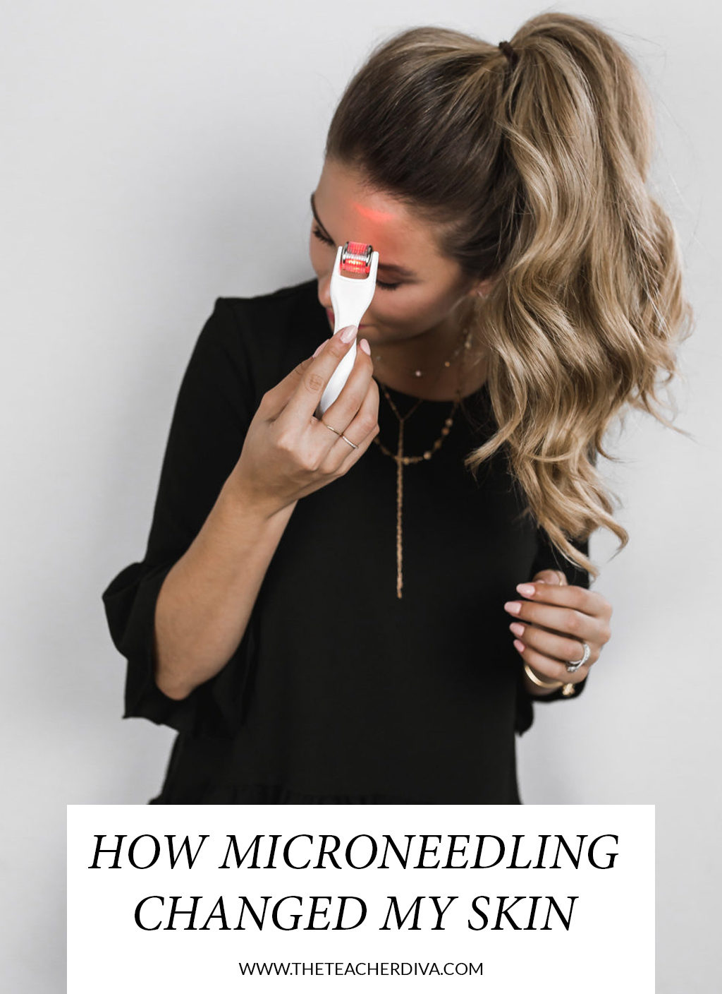 How Microneedling Changed My Skin